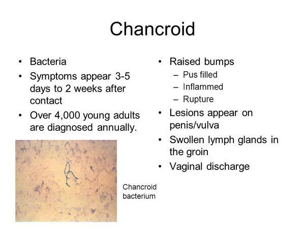 Chancroid Chancroid