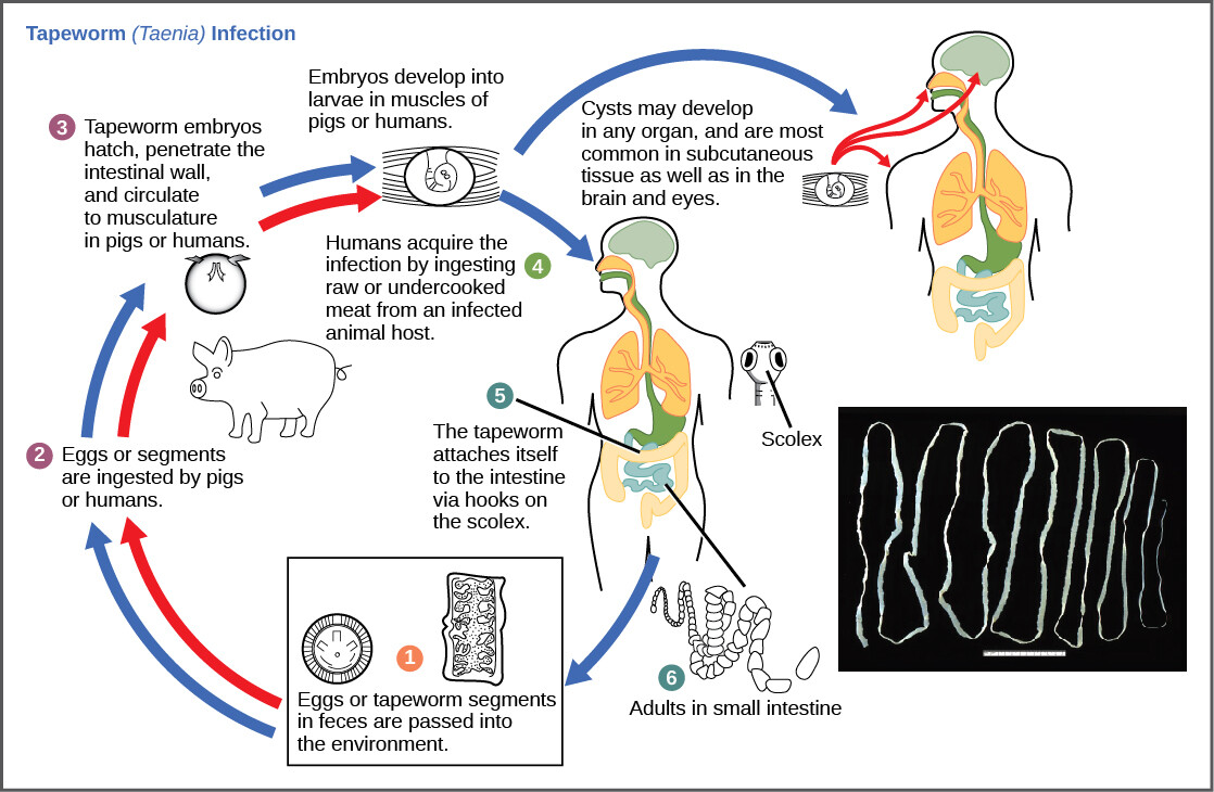 Taenia Saginata Infection Taenia Saginata Infection