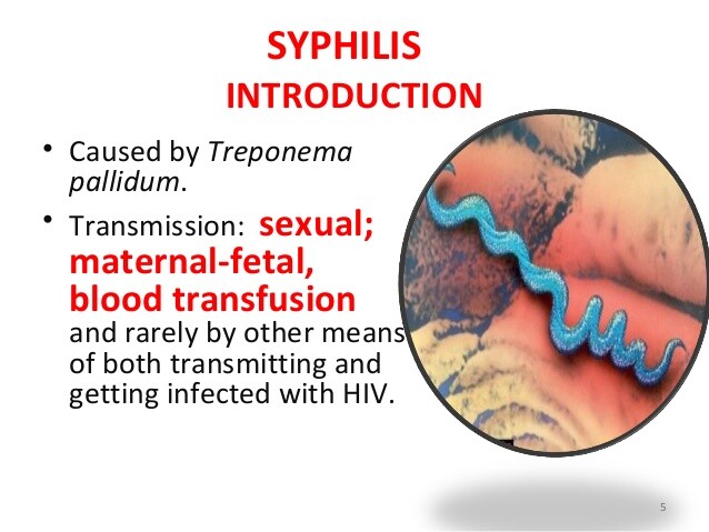 Syphilis treponema pallidum Syphilis treponema pallidum