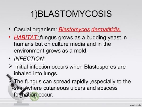 Ketoconazole Blastomycosis Ketoconazole Blastomycosis