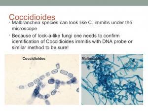 Coccidioides - Fungal Infections - AntiinfectiveMeds.com