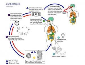 Cysticercosis (Cysticercus Cellulosea Infection) - Parasitic Infections ...