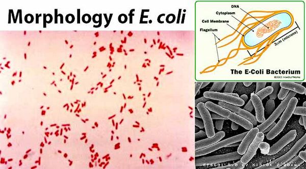 Escherichia Coli - Bacterial Infections - AntiinfectiveMeds.com