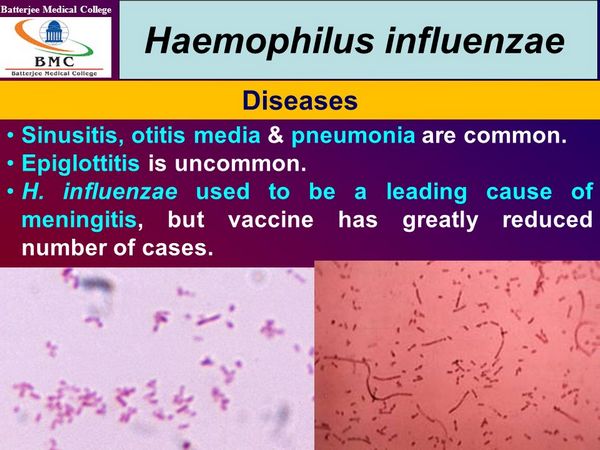 Haemophilus Influenzae: Clinical Syndromes - Bacterial Infections ...