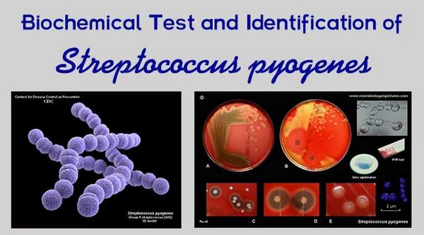 streptococcus-pyogenes-bacterial-infections-antiinfectivemeds