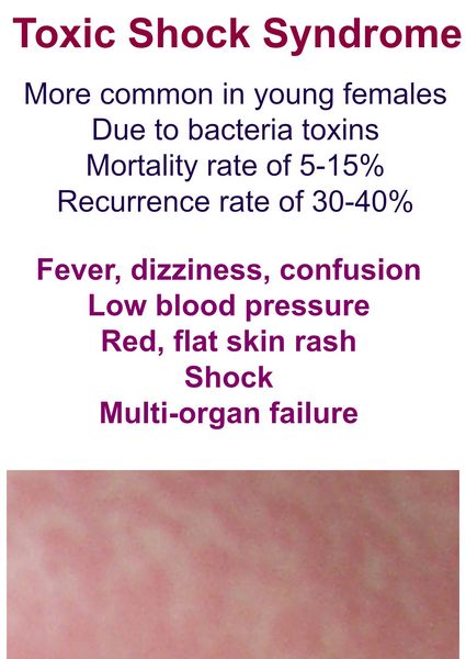 toxic-shock-syndrome-bacterial-infections-antiinfectivemeds