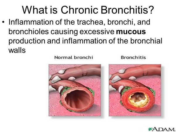 what-is-chronic-bronchitis-bronchitis-antiinfectivemeds